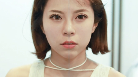 實現V臉美人計畫，讓你在術前術後都擁有驚人的改變！