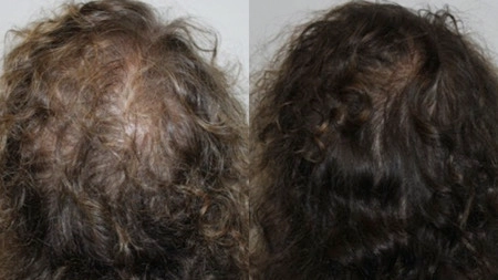 定期護理使頭皮變得檢康，髮量更旺盛！