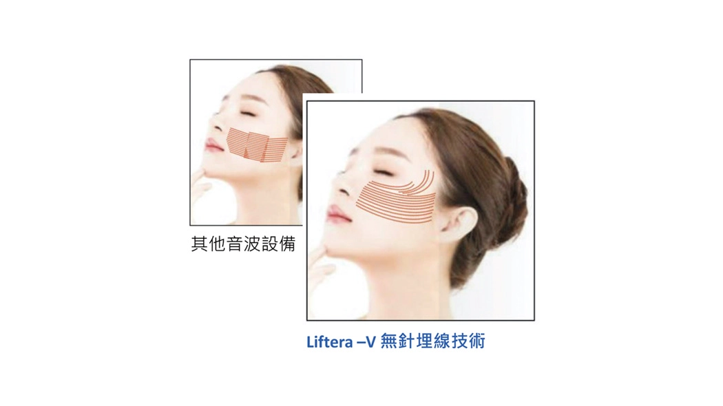 貼合臉部各種角度