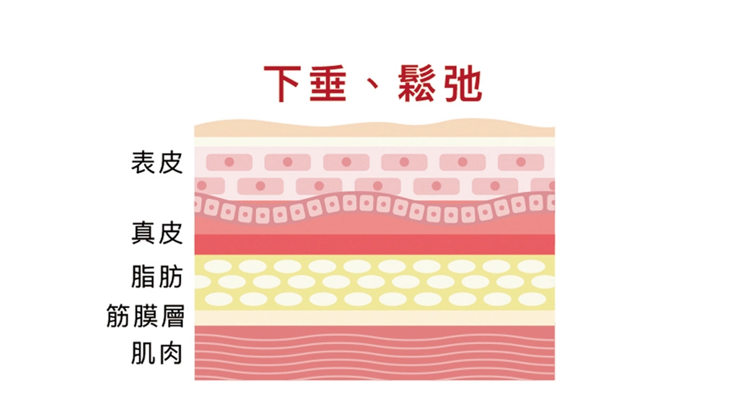 一體成型MINT線產生四倍拉力，拉提更有力