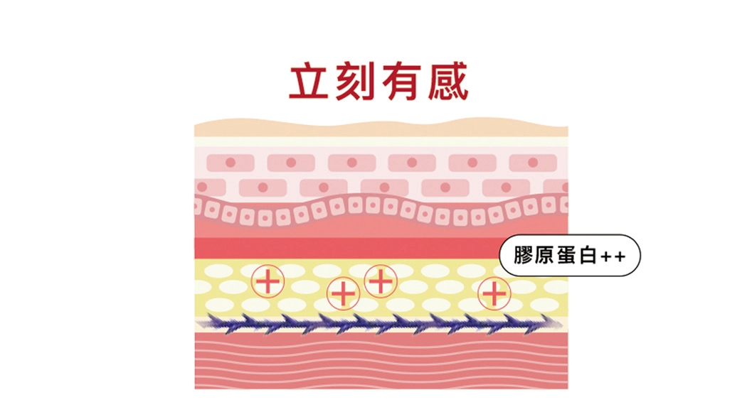 刺激膠原蛋白，拉提效果更顯著